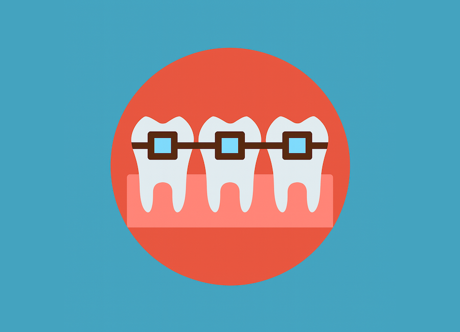 Braces illustration